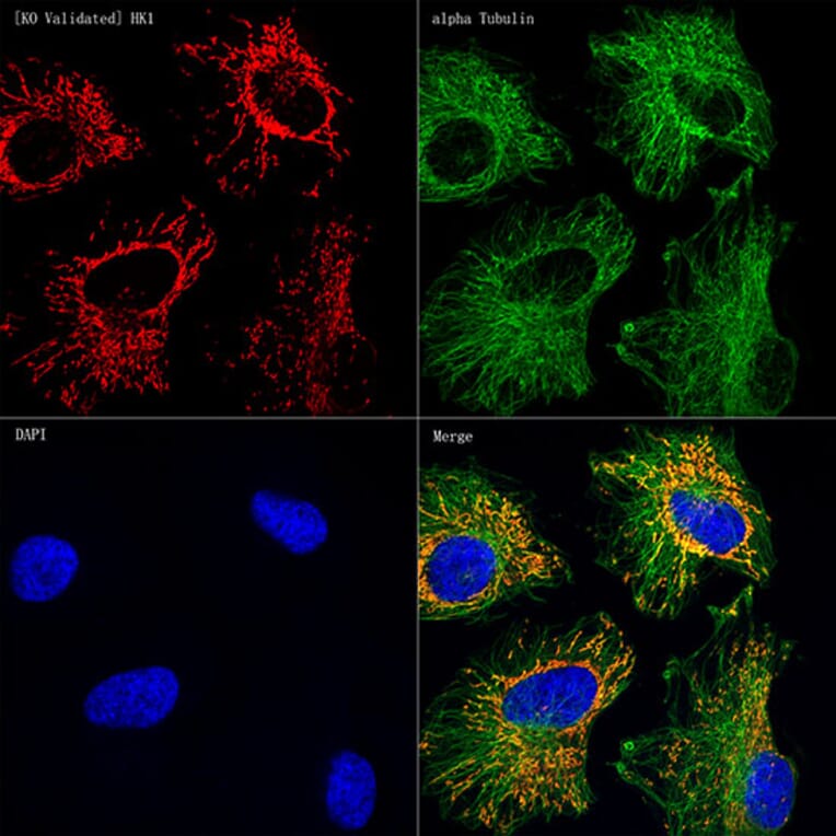 Immunofluorescence - Anti-Hexokinase 1 Antibody [ARC0256] (A306070) - Antibodies.com