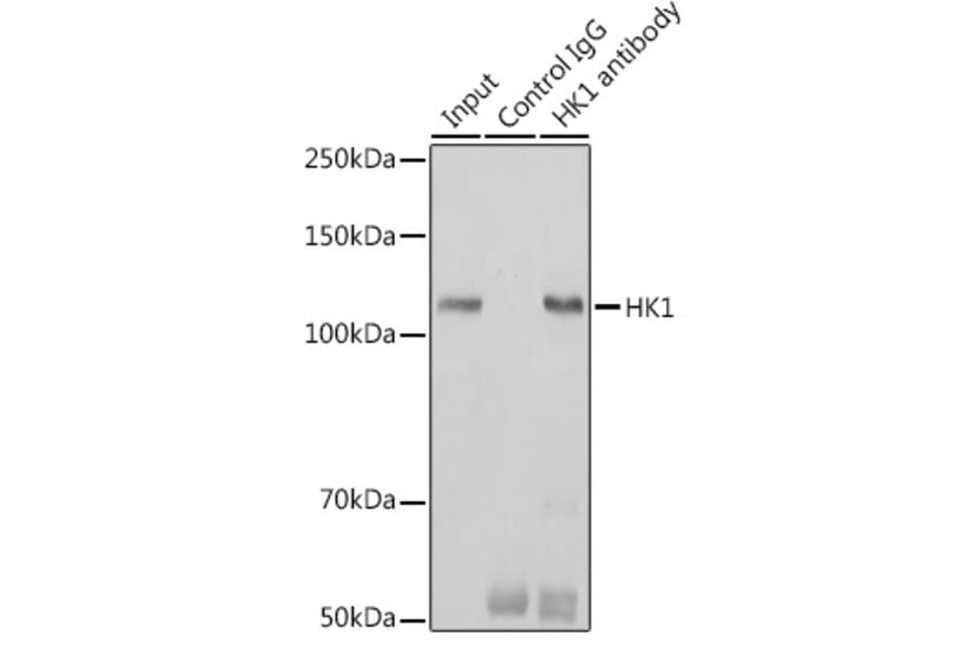 Western Blot - Anti-Hexokinase 1 Antibody [ARC0256] (A306070) - Antibodies.com
