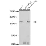 Western Blot - Anti-Hexokinase 1 Antibody [ARC0256] (A306070) - Antibodies.com