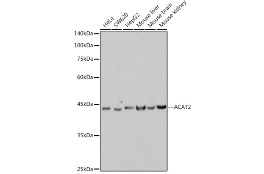 Western Blot - Anti-ACAT2/Acetyl-CoA acetyltransferase Antibody [ARC2560] (A306071) - Antibodies.com