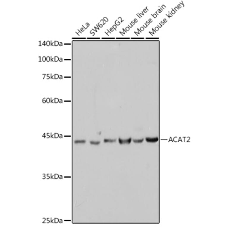 Western Blot - Anti-ACAT2/Acetyl-CoA acetyltransferase Antibody [ARC2560] (A306071) - Antibodies.com