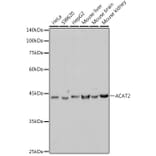 Western Blot - Anti-ACAT2/Acetyl-CoA acetyltransferase Antibody [ARC2560] (A306071) - Antibodies.com