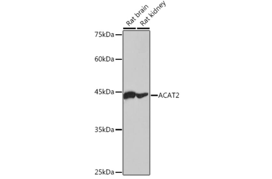 Western Blot - Anti-ACAT2/Acetyl-CoA acetyltransferase Antibody [ARC2560] (A306071) - Antibodies.com