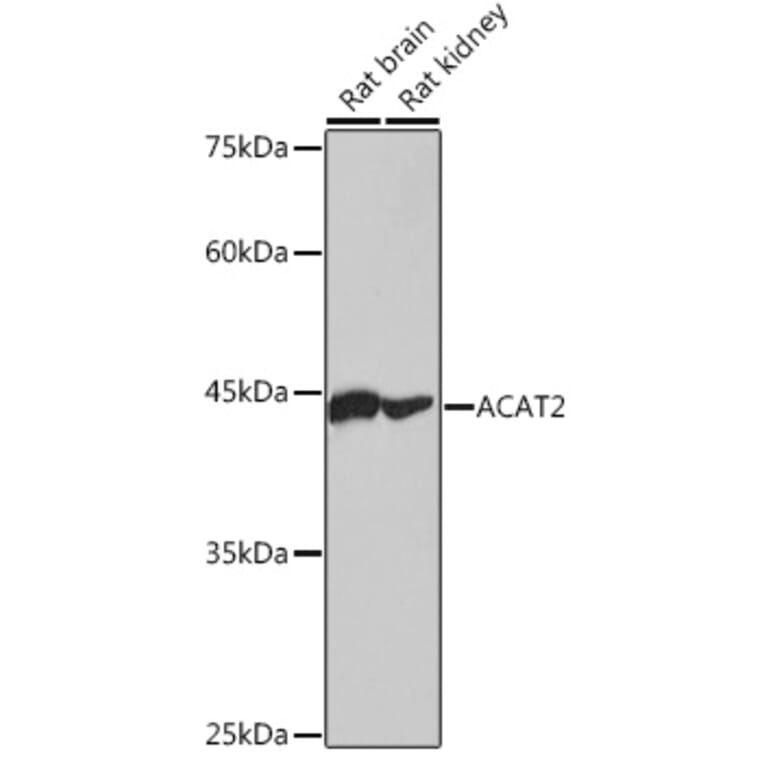 Western Blot - Anti-ACAT2/Acetyl-CoA acetyltransferase Antibody [ARC2560] (A306071) - Antibodies.com