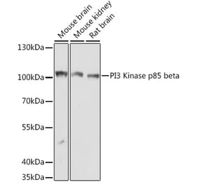 Western Blot - Anti-PI 3 Kinase p85 beta Antibody (A306072) - Antibodies.com