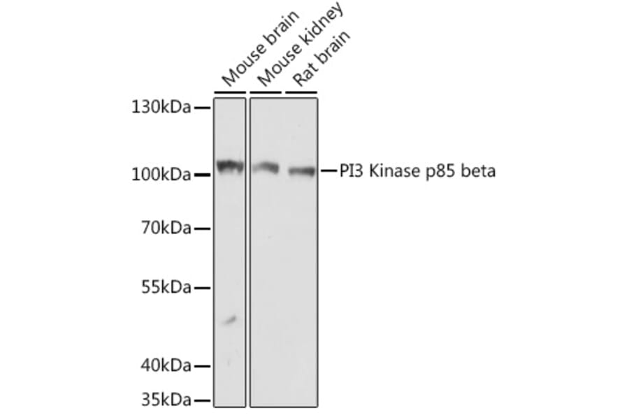 Western Blot - Anti-PI 3 Kinase p85 beta Antibody (A306072) - Antibodies.com