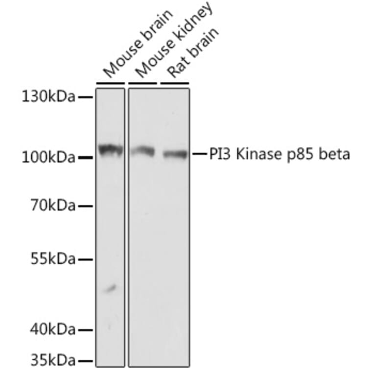 Western Blot - Anti-PI 3 Kinase p85 beta Antibody (A306072) - Antibodies.com