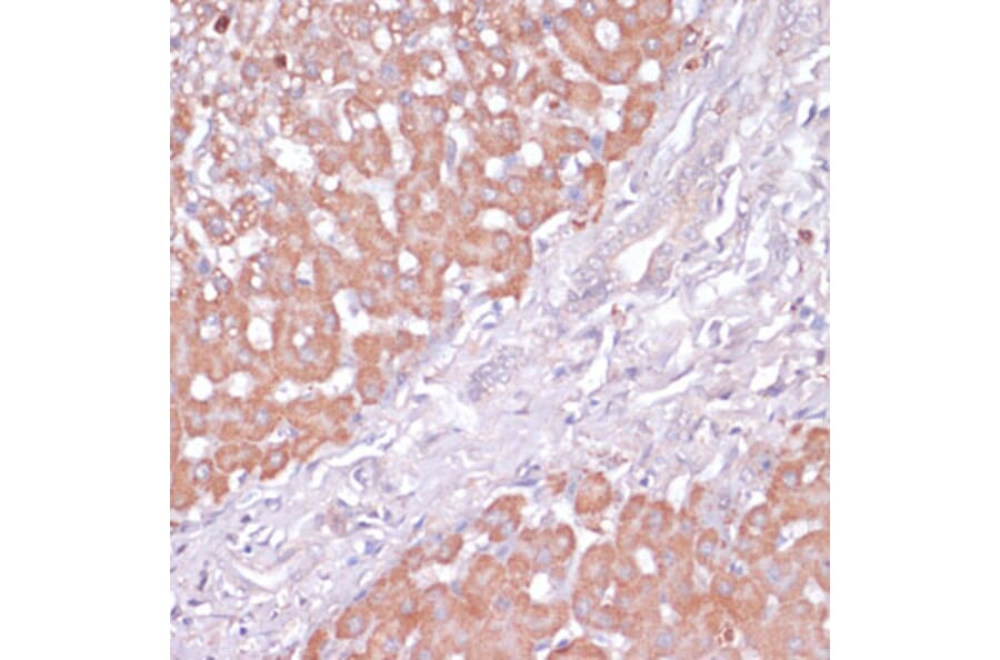 Immunohistochemistry - Anti-PI 3 Kinase p85 beta Antibody (A306072) - Antibodies.com
