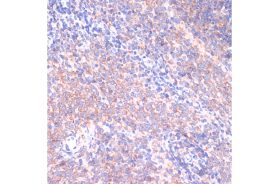 Immunohistochemistry - Anti-PI 3 Kinase p85 beta Antibody (A306072) - Antibodies.com