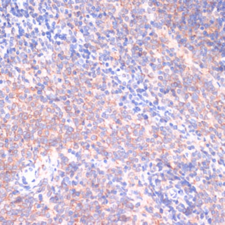 Immunohistochemistry - Anti-PI 3 Kinase p85 beta Antibody (A306072) - Antibodies.com
