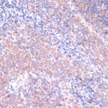 Immunohistochemistry - Anti-PI 3 Kinase p85 beta Antibody (A306072) - Antibodies.com
