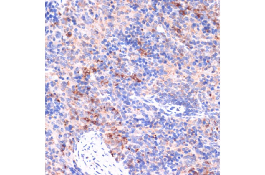 Immunohistochemistry - Anti-PI 3 Kinase p85 beta Antibody (A306072) - Antibodies.com