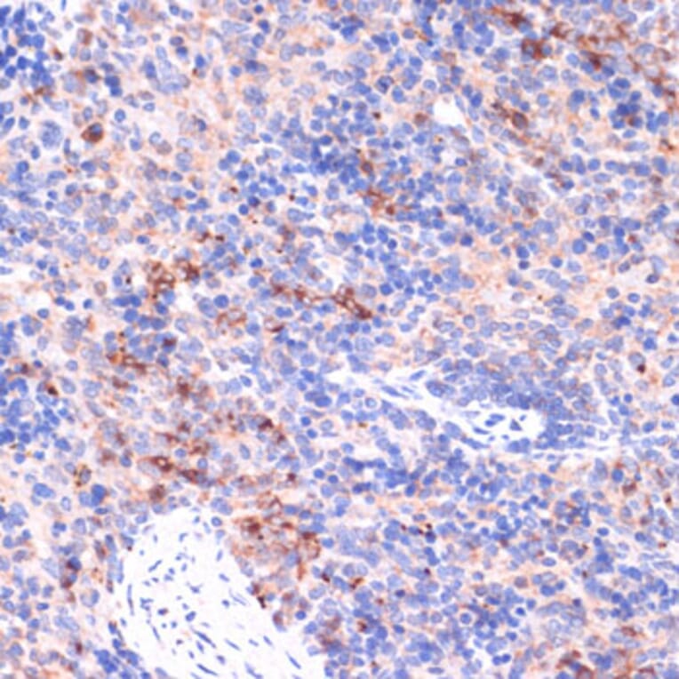 Immunohistochemistry - Anti-PI 3 Kinase p85 beta Antibody (A306072) - Antibodies.com