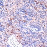 Immunohistochemistry - Anti-PI 3 Kinase p85 beta Antibody (A306072) - Antibodies.com