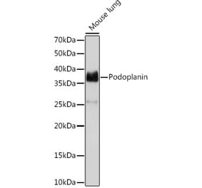 Western Blot - Anti-Podoplanin / gp36 Antibody [ARC1488] (A306073) - Antibodies.com