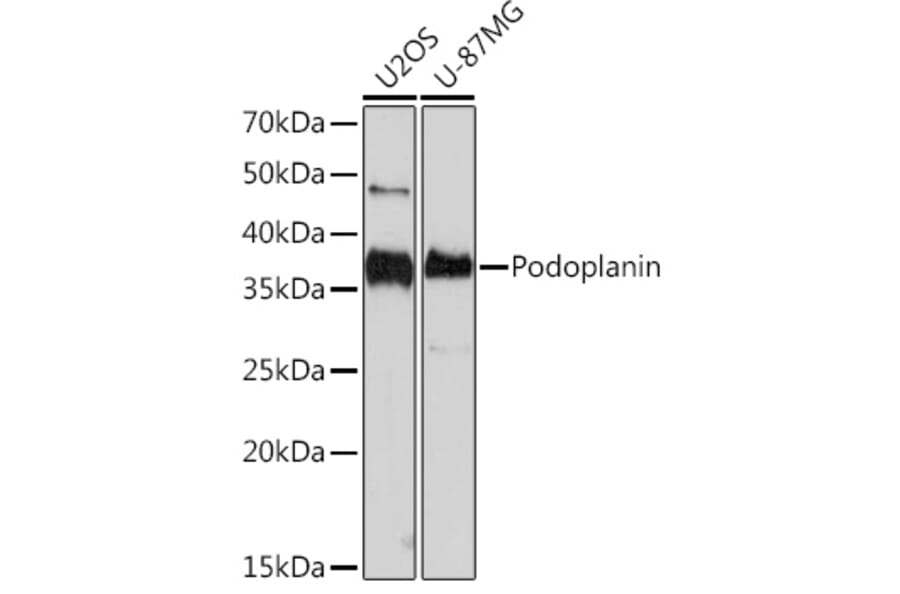 Western Blot - Anti-Podoplanin/gp36 Antibody [ARC1488] (A306073) - Antibodies.com