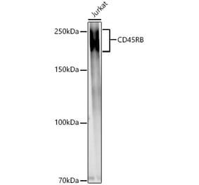 Western Blot - Anti-CD45 Antibody (A306074) - Antibodies.com