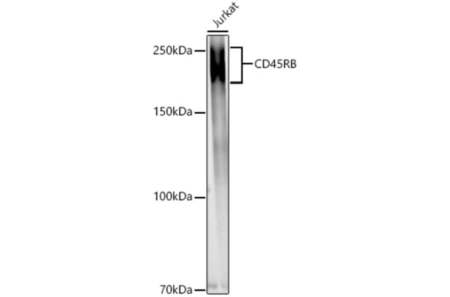 Western Blot - Anti-CD45 Antibody (A306074) - Antibodies.com