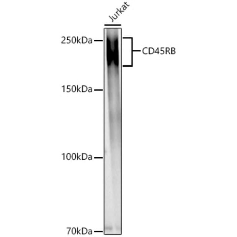 Western Blot - Anti-CD45 Antibody (A306074) - Antibodies.com
