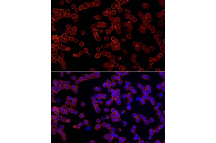Immunofluorescence - Anti-CD45 Antibody (A306074) - Antibodies.com