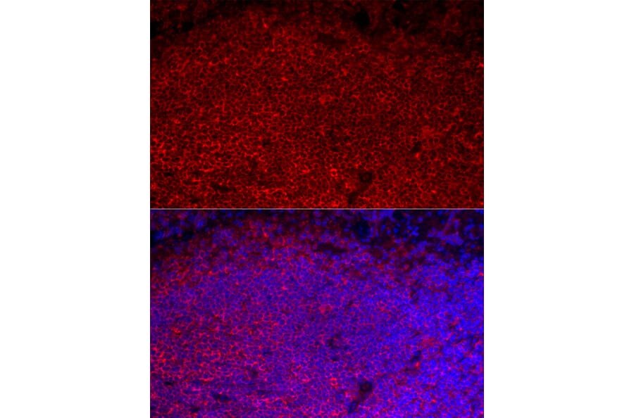 Immunofluorescence - Anti-CD45 Antibody (A306074) - Antibodies.com
