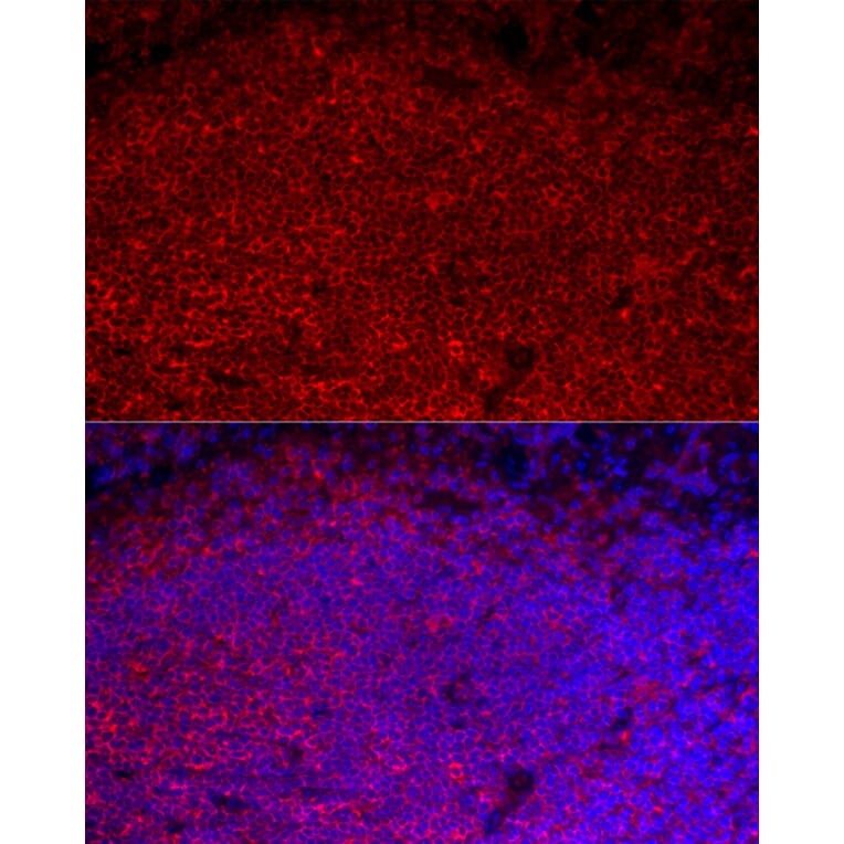 Immunofluorescence - Anti-CD45 Antibody (A306074) - Antibodies.com