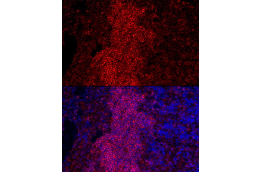 Immunofluorescence - Anti-CD45 Antibody (A306074) - Antibodies.com