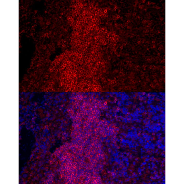 Immunofluorescence - Anti-CD45 Antibody (A306074) - Antibodies.com