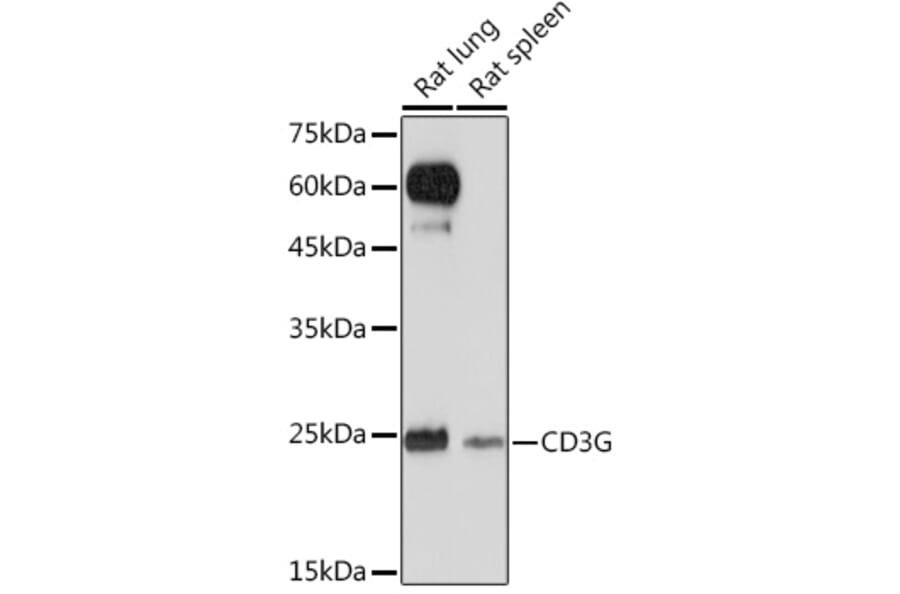 Western Blot - Anti-CD3G Antibody [ARC2105] (A306075) - Antibodies.com