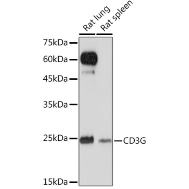 Western Blot - Anti-CD3G Antibody [ARC2105] (A306075) - Antibodies.com