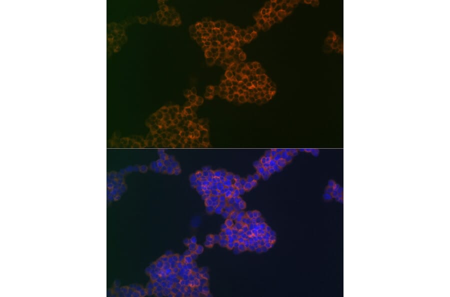 Immunofluorescence - Anti-CD3G Antibody [ARC2105] (A306075) - Antibodies.com