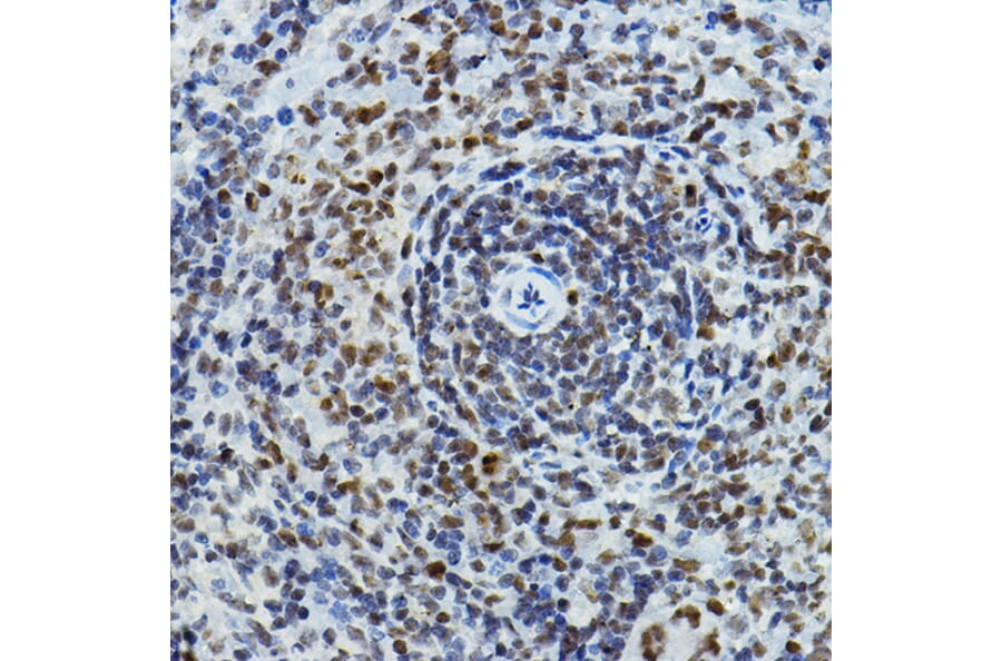 Immunohistochemistry - Anti-PTIP Antibody (A306076) - Antibodies.com