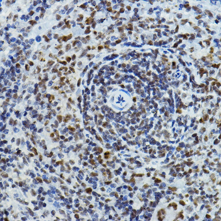Immunohistochemistry - Anti-PTIP Antibody (A306076) - Antibodies.com