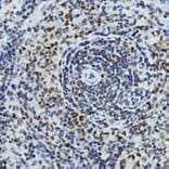 Immunohistochemistry - Anti-PTIP Antibody (A306076) - Antibodies.com