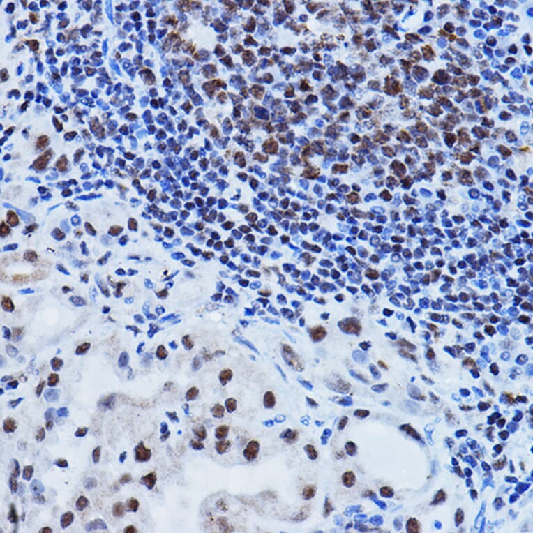 Immunohistochemistry - Anti-PTIP Antibody (A306076) - Antibodies.com