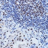 Immunohistochemistry - Anti-PTIP Antibody (A306076) - Antibodies.com