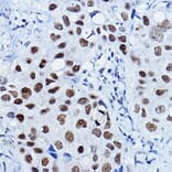 Immunohistochemistry - Anti-PTIP Antibody (A306076) - Antibodies.com