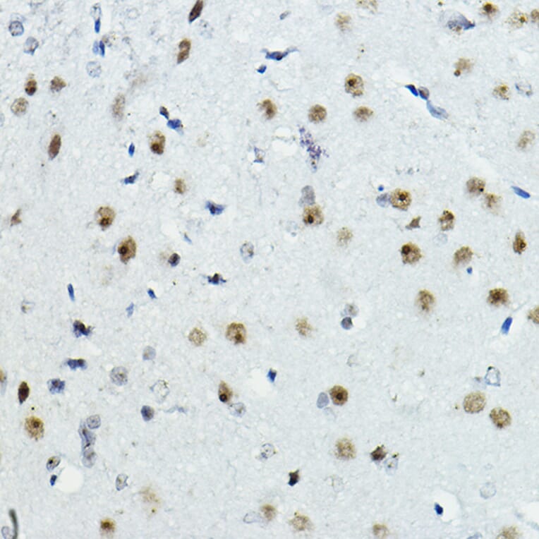 Immunohistochemistry - Anti-PTIP Antibody (A306076) - Antibodies.com