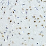 Immunohistochemistry - Anti-PTIP Antibody (A306076) - Antibodies.com