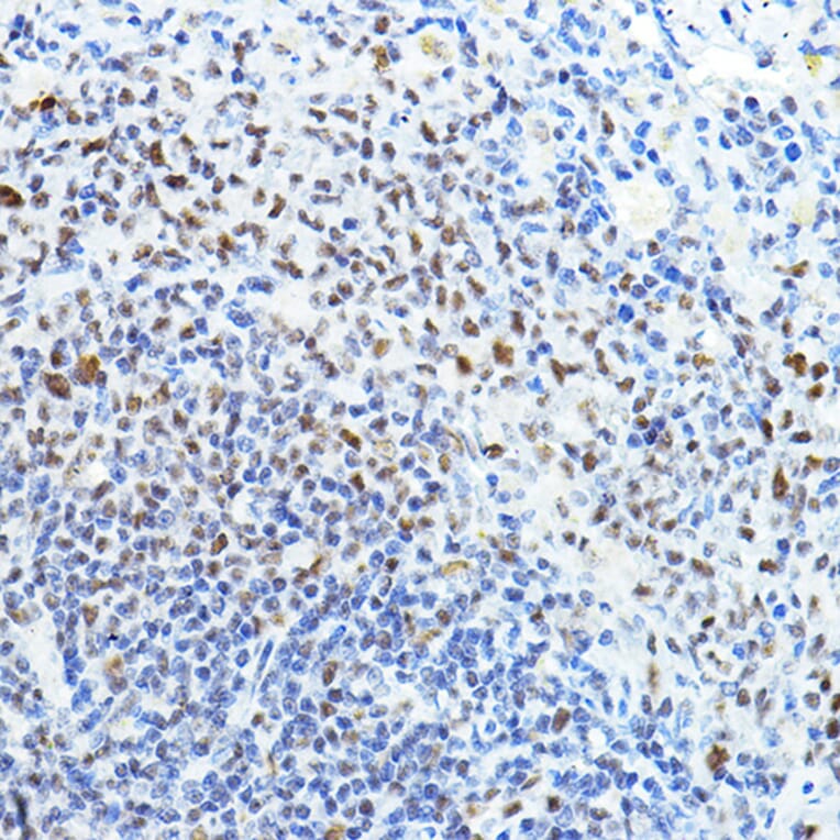 Immunohistochemistry - Anti-PTIP Antibody (A306076) - Antibodies.com