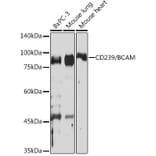 Western Blot - Anti-CD239/BCAM Antibody [ARC2252] (A306077) - Antibodies.com