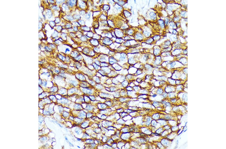 Immunohistochemistry - Anti-CD239/BCAM Antibody [ARC2252] (A306077) - Antibodies.com