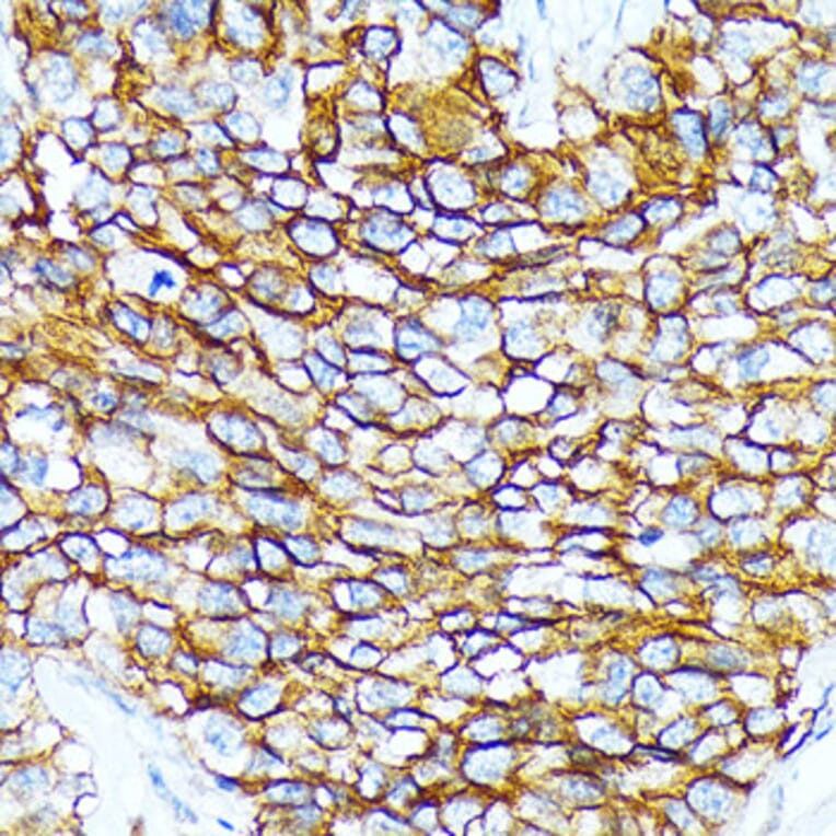 Immunohistochemistry - Anti-CD239/BCAM Antibody [ARC2252] (A306077) - Antibodies.com