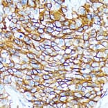 Immunohistochemistry - Anti-CD239/BCAM Antibody [ARC2252] (A306077) - Antibodies.com