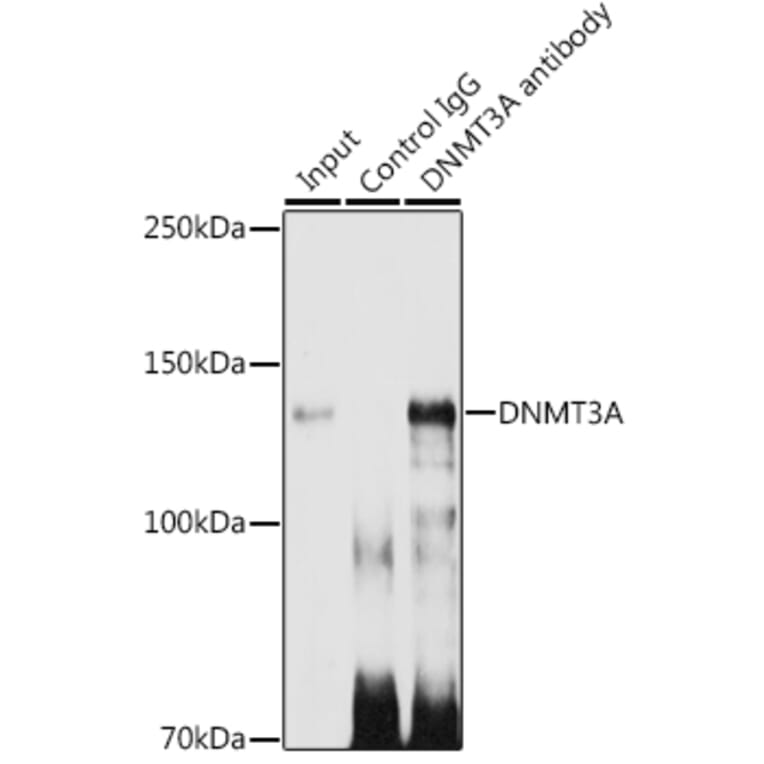 Western Blot - Anti-Dnmt3a Antibody [ARC0138] (A306078) - Antibodies.com