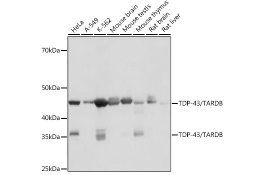 Western Blot - Anti-TDP43 Antibody [ARC0492] (A306079) - Antibodies.com