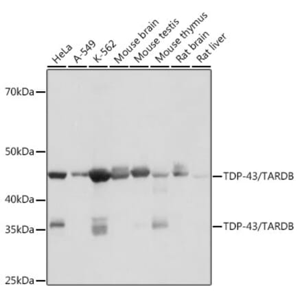 Western Blot - Anti-TDP43 Antibody [ARC0492] (A306079) - Antibodies.com