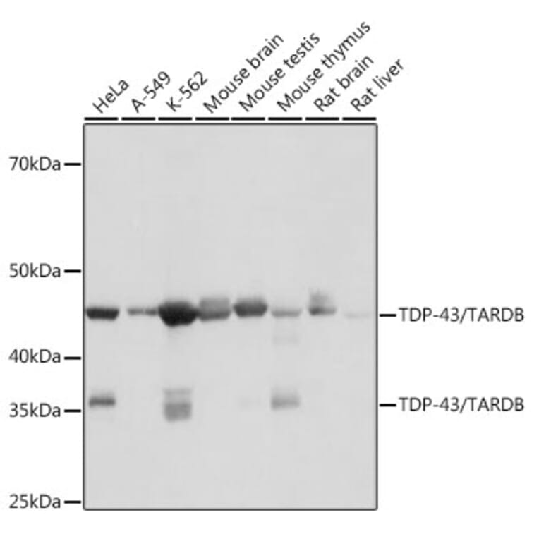 Western Blot - Anti-TDP43 Antibody [ARC0492] (A306079) - Antibodies.com