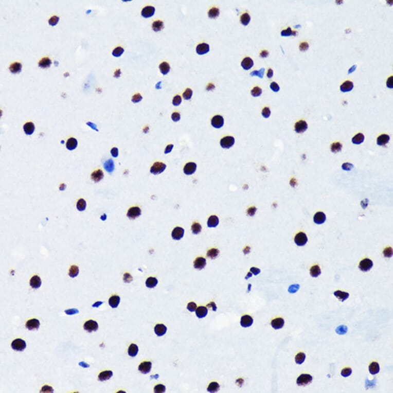 Immunohistochemistry - Anti-TDP43 Antibody [ARC0492] (A306079) - Antibodies.com