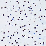 Immunohistochemistry - Anti-TDP43 Antibody [ARC0492] (A306079) - Antibodies.com